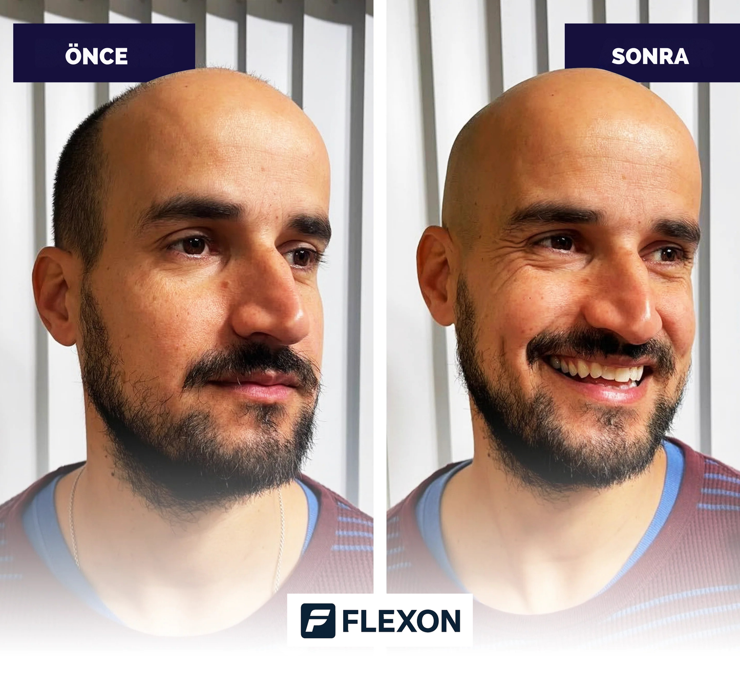FLEXON FORCE® Şarjlı Tıraş Seti
