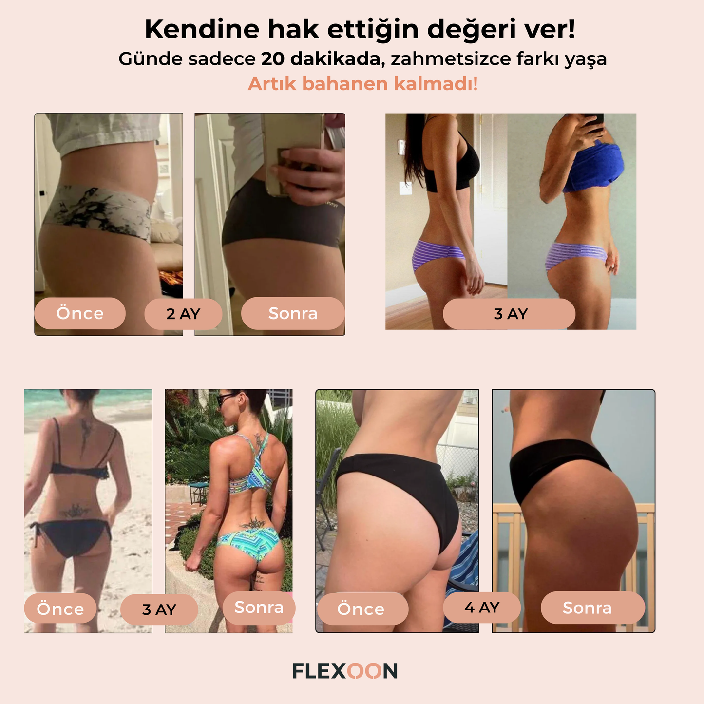 Flexoon Lift™ Kalça Şekillendirici