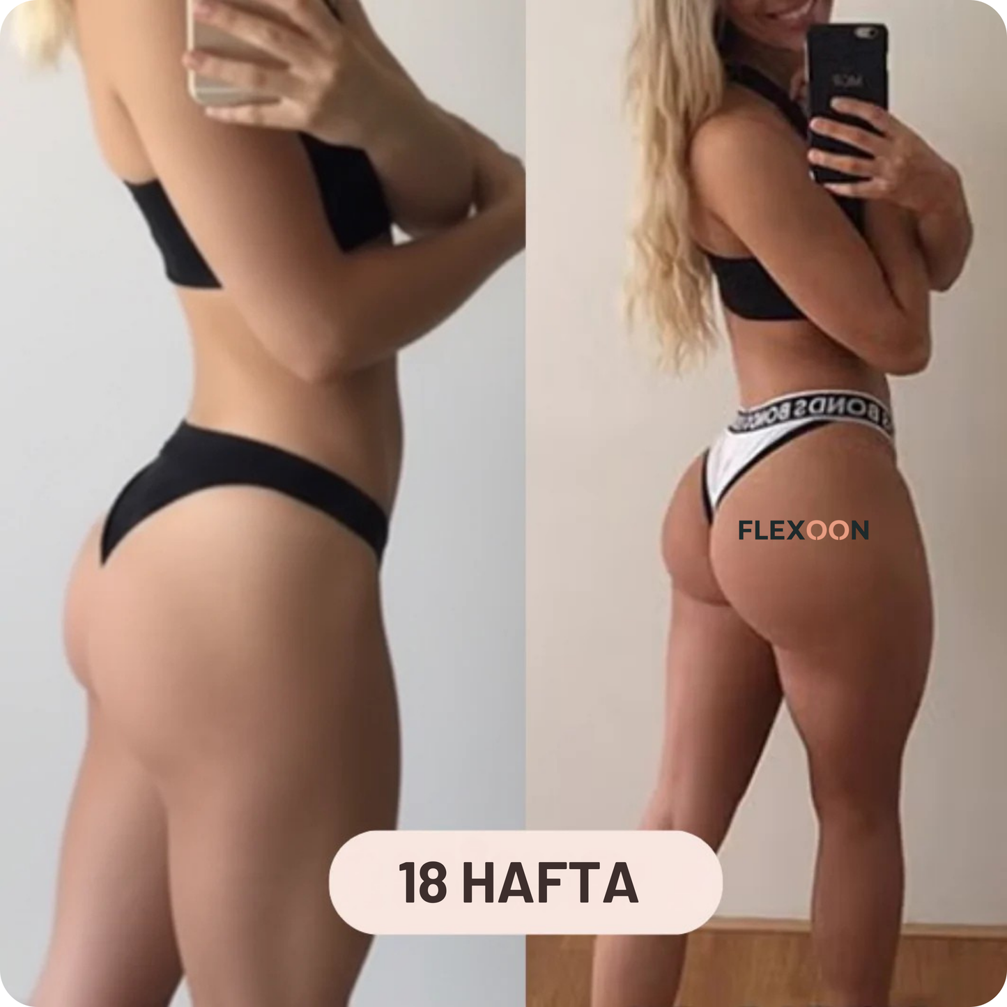 Flexoon Lift™ Kalça Şekillendirici